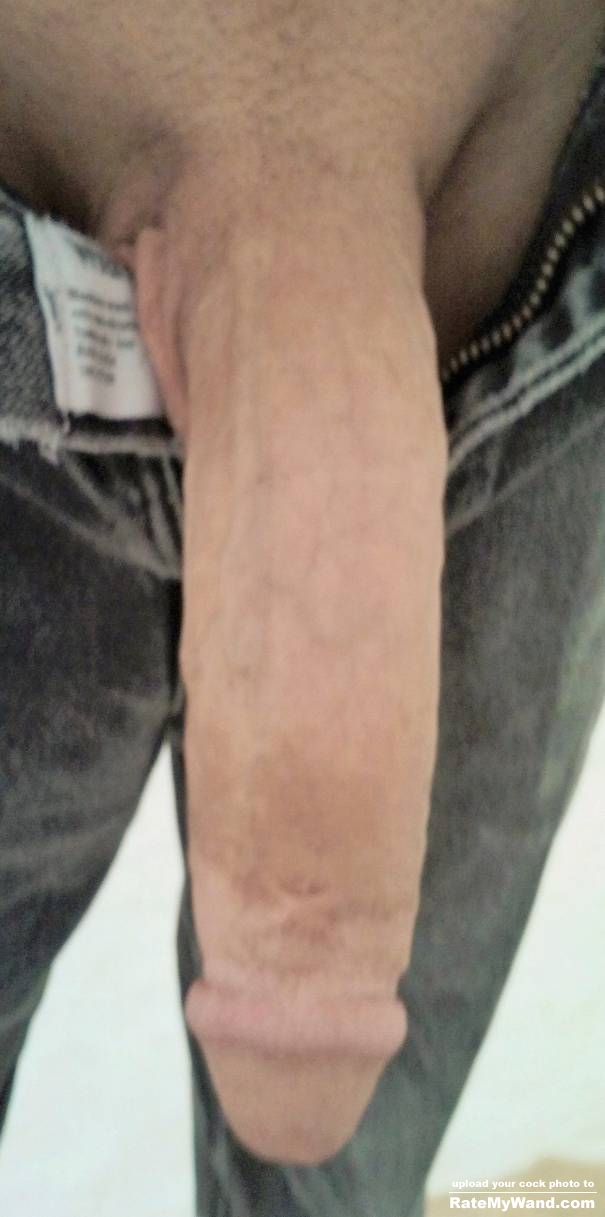 can see my scar from bicycle chain - Rate My Wand